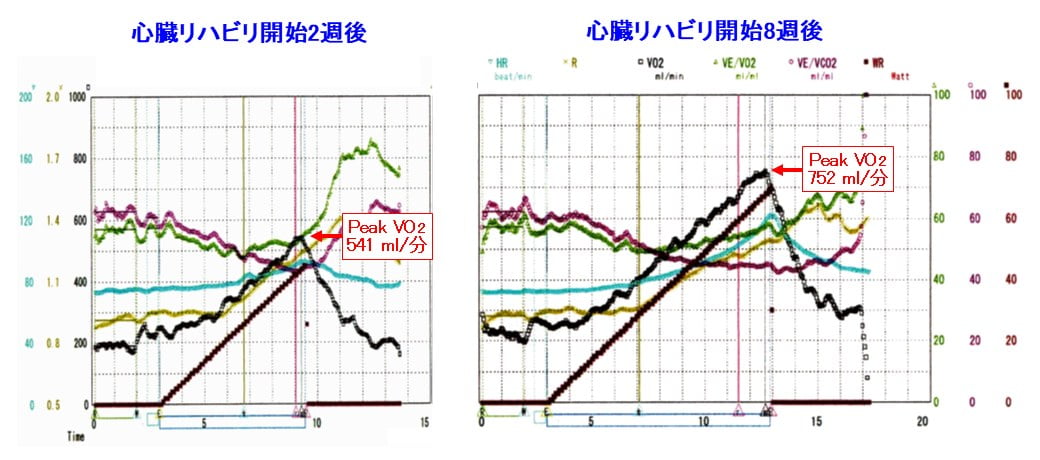 CPX検査結果の例のグラフ