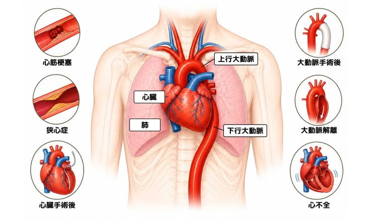 心臓リハビリテーションの対象となる病気の図解